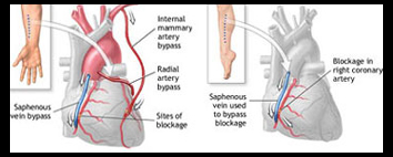 Apollo Specialty Hospital, Apollo Specialty Cancer Hospital